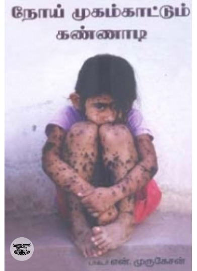 நோய் முகம்காட்டும் கண்ணாடி